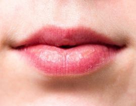Wrinkles Above the Lips: The Best Treatments & Prevention